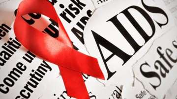 HIV AIDS