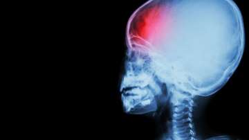 Head injury may cause loss of smell, anxiety