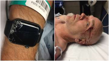 This is how an Apple Watch saved a man's life after detecting accident