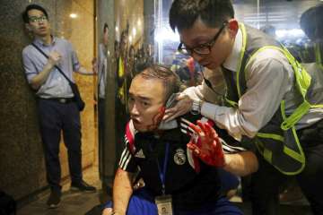 Hong Kong protests knife attack pro democracy