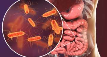 Indian-origin scientist finds dead probiotic that can fix leaky gut