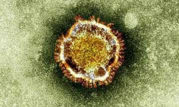 4 suspected coronavirus cases surface in Pakistan