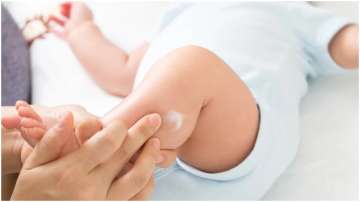 Using daily moisturisers cannot prevent eczema in babies