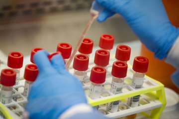 Italy registers 69,176 coronavirus cases, 743 new deaths