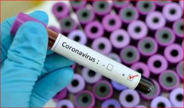 J&K on alert against coronavirus, no positive case reported (Representational image)