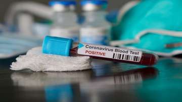 COVID-19 in Chhattisgarh: 2 more test positive for coronavirus in Raipur, Rajnandgaon; total rises t