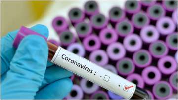  COVID-19 in Gujarat: 4 more coronavirus cases reported in Surat including 3 local transmissions