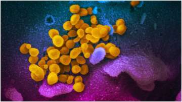 COVID-19 coronavirus is seen in yellow, emerging from cells (in blue and pink) cultured in the lab. This image is from a scanning electron microscope.