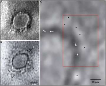 Transmission electron microscopy imaging of COVID-19. 