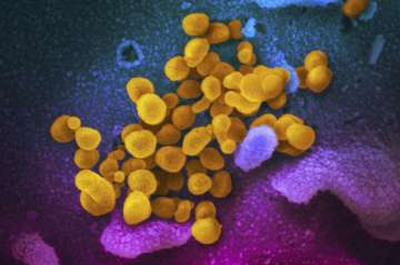 This undated electron microscope image made available by the U.S. National Institutes of Health in February 2020 shows the Novel Coronavirus SARS-CoV-2, yellow, emerging from the surface of cells, blue/pink, cultured in the lab. Also known as 2019-nCoV, the virus causes COVID-19.?
