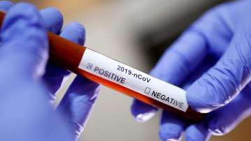 Over 50 journalists test positive for coronavirus in Mumbai