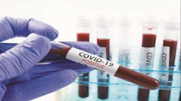 Punjab: 3 more test positive for coronavirus in Mohali, Jagatpura; tally rises to 44