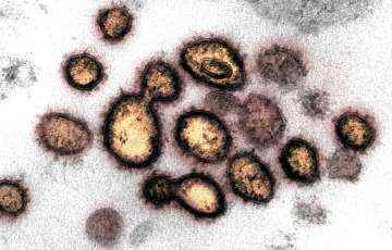 Mutant coronavirus has emerged and it's more dangerous, says study