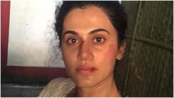 Taapsee Pannu is all bruised in latest post, says it's 'the picture you send to your mom to scare he