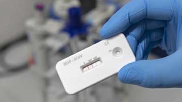 PGIMER to conduct clinical trial for rapid antigen detection