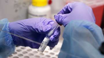 Coronavirus tests india, coronavirus testing facility