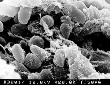 Bubonic plague microscope bacteria