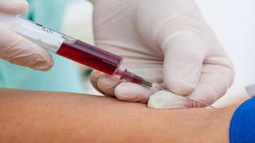 'Blood test may tell if you are at risk of severe COVID-19 infection'	