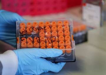Russia to register world's first coronavirus vaccine on August 12