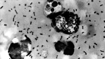 Suspected bubonic plague case in Mongolia tests negative
