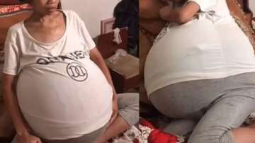 Woman's belly swelling up 'uncontrollably' due to mysterious medical condition in China