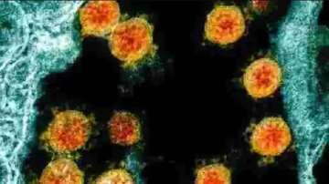 How coronavirus interacts with proteins in human cells decoded