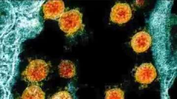 KGMU begins gene sequencing of coronavirus to detect its new strains