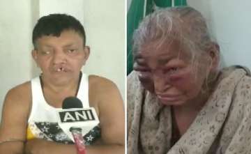 West Bengal: BJP worker's mother, who was allegedly attacked by TMC workers in February, dies