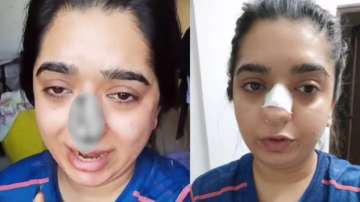 Zomato delivery boy, woman punched, bengaluru social media influencer hitesha chandranee punched, be