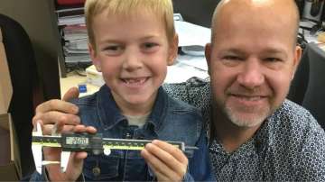 9-year-old Canada boy holds Guinness World Record for longest milk tooth extracted