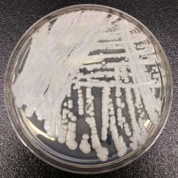 candida auris superbug fungus