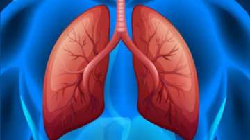 Cells damaged by chronic lung disease can result in severe Covid