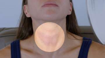 4 reasons women should be aware of thyroid disorders