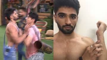 Bigg Boss OTT: Zeeshan Khan told to leave after fight with Pratik Sehajpal, shares pic of his injuri