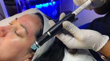 Chemical peels to hydrafacials, get your face ready for the wedding season!