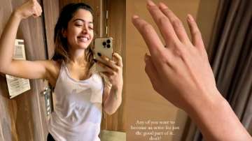 Pushpa actress Rashmika Mandanna shares picture of her hand after painful laser treatment 