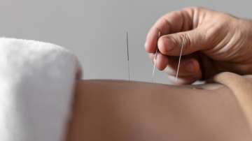 Can acupuncture restore thyroid balance in the body?