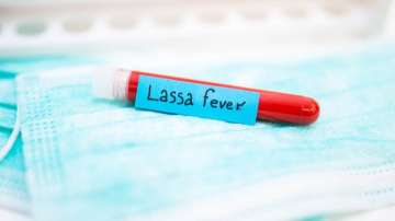 Lassa Fever