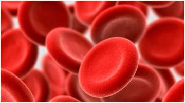 8 symptoms of anemia and its precautions