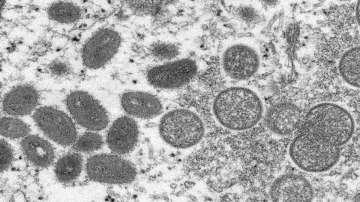 This 2003 electron microscope image made available by the Centers for Disease Control and Prevention shows mature, oval-shaped monkeypox virions, left, and spherical immature virions, right, obtained from a sample of human skin associated with the 2003 prairie dog outbreak. The World Health Organization said Friday, May 27, 2022, that nearly 200 cases of monkeypox have been reported in more than 20 countries not usually known to have outbreaks of the unusual disease.
