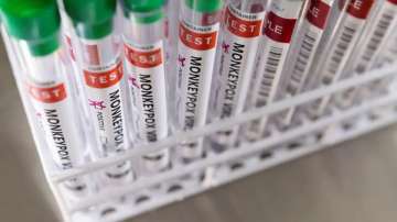 Monkeypox, Trivitron Healthcare, Monkeypox detection kit, Monkeypox virus, cases of monkeypox virus,