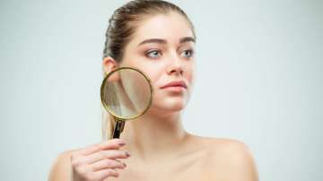 Dos and Don'ts for flaky skin in summers