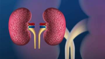 Kidney Cancer: Know symptoms, causes and treatment