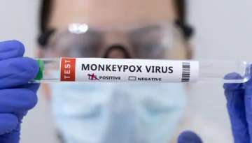 monkeypox, monkeypox virus