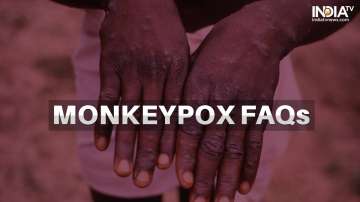 Monkeypox FAQs