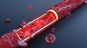  By increasing the level of blood platelets, you can prevent bleeding