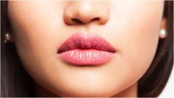 Representative image of a woman having chapped lips