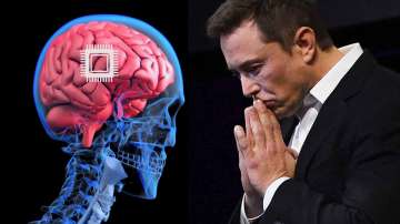 Elon Musk, Neuralink Receives FDA Approval, Human Brain Implants