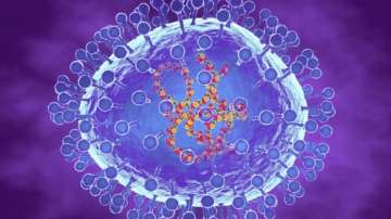 Human metapneumovirus is an infection that affects the upper and lower respiratory tract.