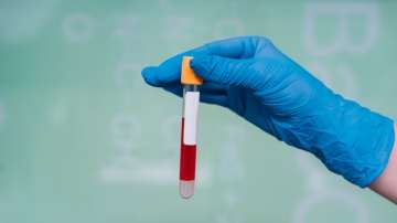 Blood test for Preeclampsia